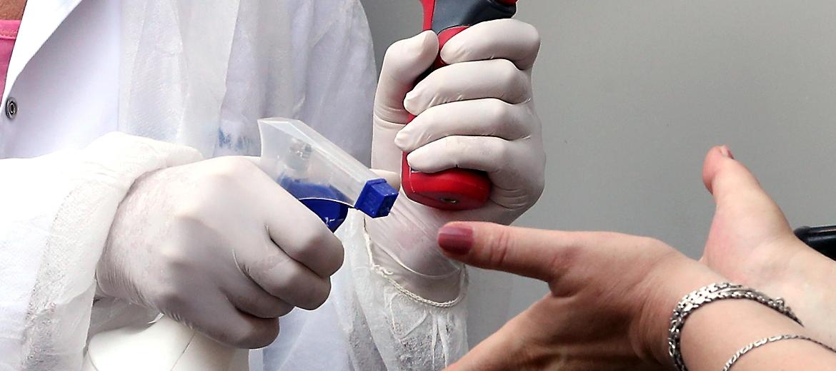 Igienizzanti, rischi per cute e vie aeree