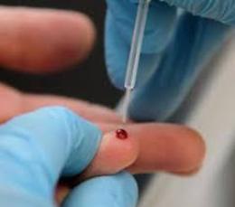 Quanti hanno anticorpi? Partono i test 