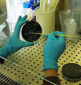 Morto di legionella. Il batterio rilevato in un hotel vicino