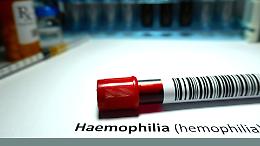 Emofilia B: primo paziente trattato in Italia con la terapia genica 