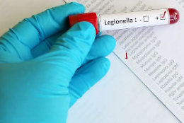 Legionella, 65enne cremonese muore dopo 4 giorni di ricovero