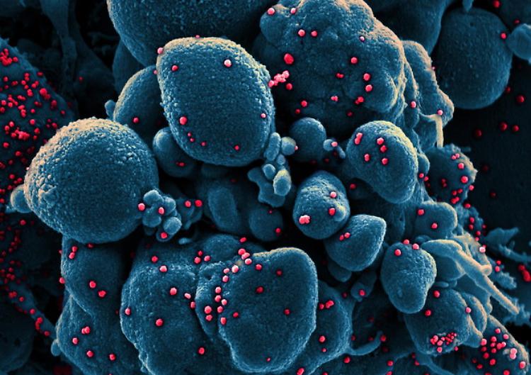 Virus, Oms: crescono disturbi psiche