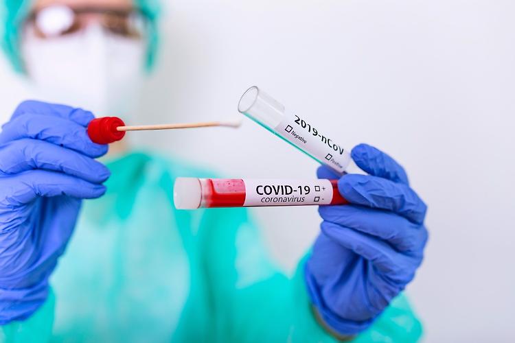 Covid, in Lombardia 18.667 contagi e tasso di positività record